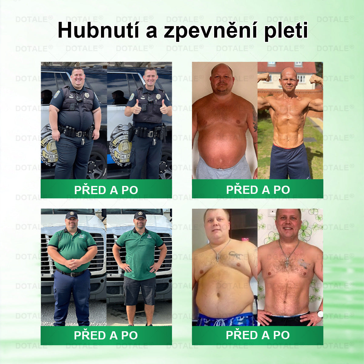 𝑫𝑶𝑻𝑨𝑳𝑬® metabolická nano mikrojehličková náplast 🧑‍⚕️ (Pouze jednou denně, viditelné výsledky již do 7 dnů!) ✅ Formule Berberin + Moringa, ideální při nadváze, nedokonalostech pokožky, diabetu, spánkové apnoe a kloubních potížích 💥💥