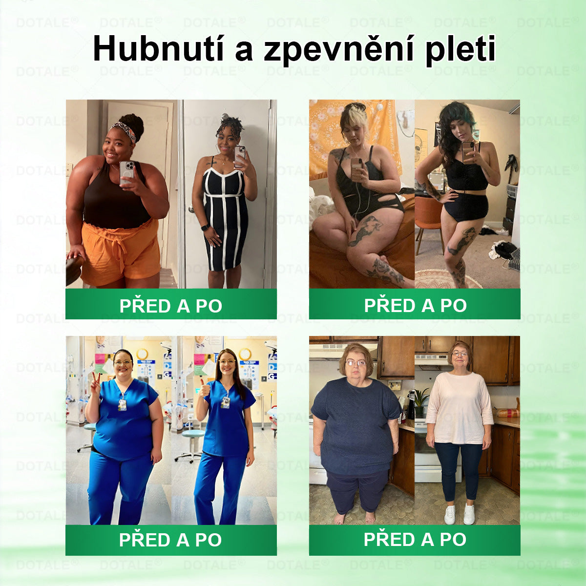 𝑫𝑶𝑻𝑨𝑳𝑬® metabolická nano mikrojehličková náplast 🧑‍⚕️ (Pouze jednou denně, viditelné výsledky již do 7 dnů!) ✅ Formule Berberin + Moringa, ideální při nadváze, nedokonalostech pokožky, diabetu, spánkové apnoe a kloubních potížích 💥💥